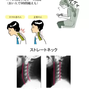 痩せ型でも二重アゴが気になる！！ こんな悩みはありませんか？ のサムネイル
